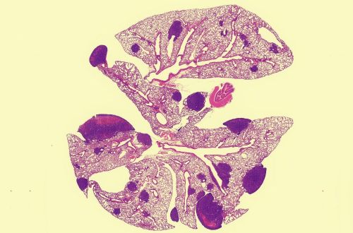 Mouse lung tissue showing PCSK9’s impact